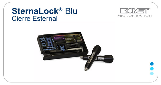 SternaLock